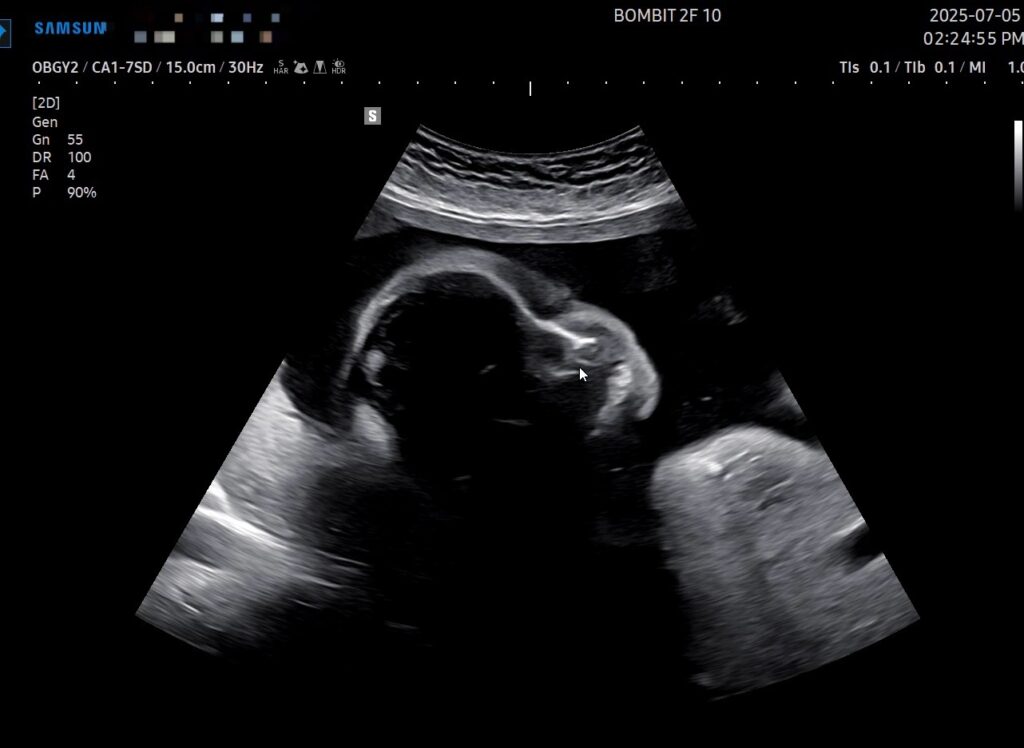 This image has an empty alt attribute; its file name is videocapture_20250708-1606305378070047750685714-1024x748.jpg