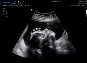 Read more about the article 단비의 폭풍 성장