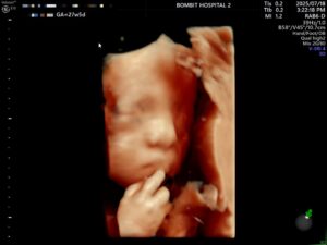 Read more about the article 단비의 입체초음파