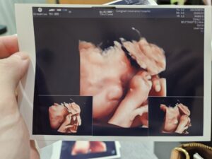 Read more about the article 대학병원으로 전원 – 강남세브란스 산부인과 초진 솔직 후기