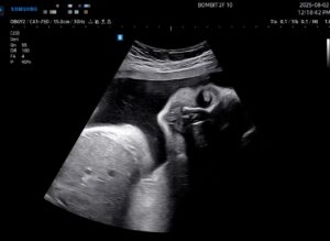 Read more about the article 우량아 단비의 30주차 검진